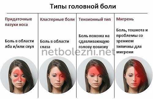 Типы головной боли