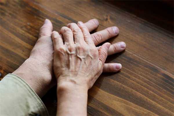 болезнь паркинсона что это простыми словами