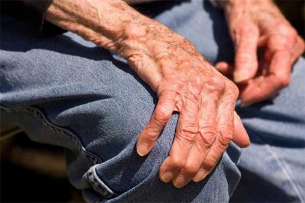 болезнь паркинсона