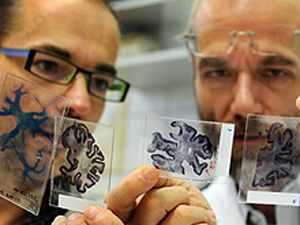 Генетические болезни ЦНС