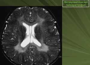 диагностика болезни