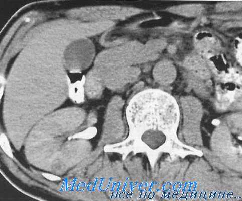Абдоминальная компьютерная томография. Предостережения при обследовании хирургических больных.