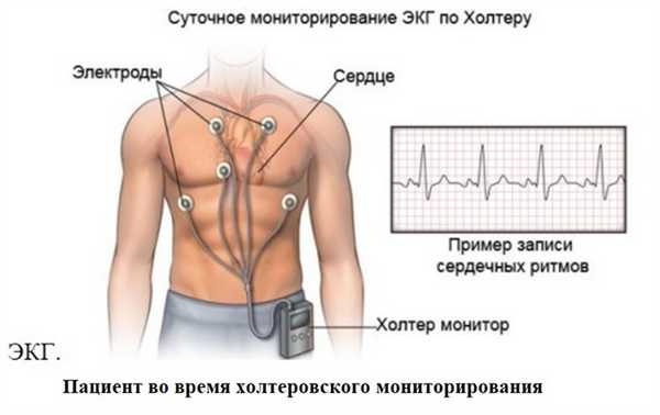 Пациент во время холтеровского мониторирования