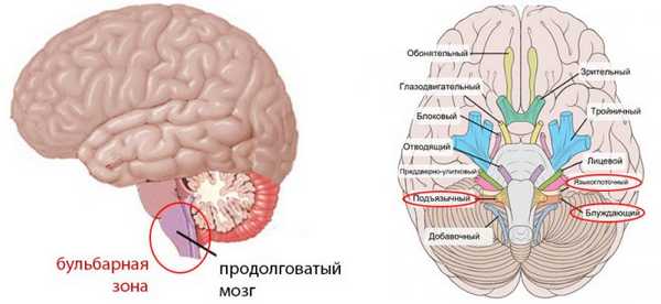 Псевдобульбарный синдром