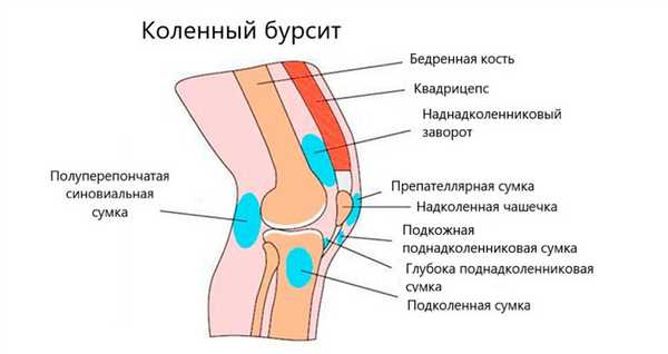 Бурсы коленного сустава