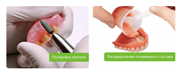 корректировка съемного протеза