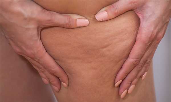 Как улучшить внешний вид тела в проблемных зонах?