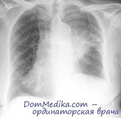 рак легкого