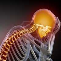 Цервикокраниалгия