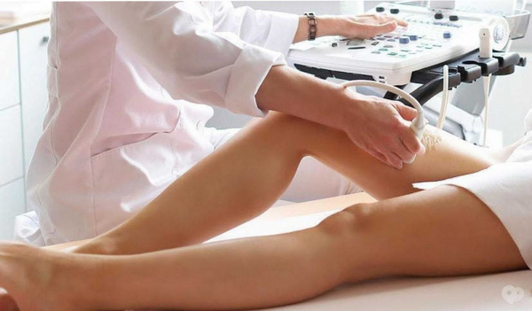 УЗИ сосудов нижних конечностей