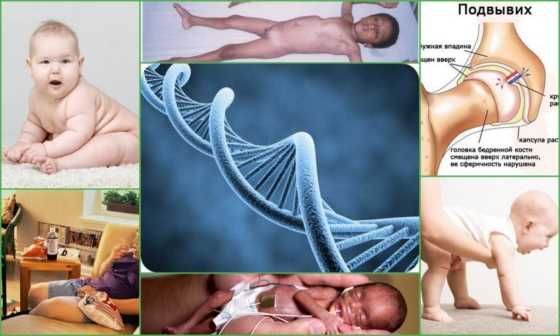 Причины развития искривления ног у ребенка