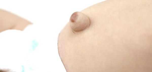 Пигментация кожи пупочной грыжи