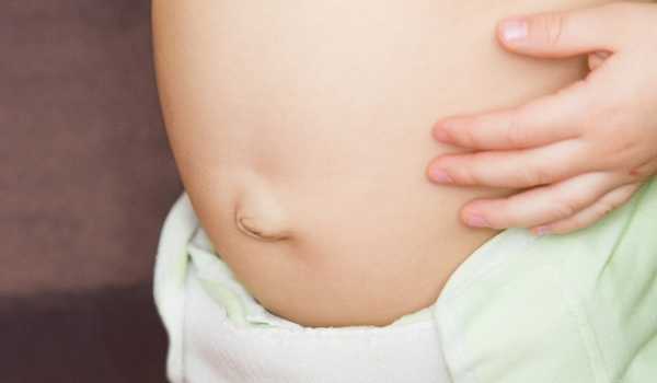 Причины пупочной грыжи у ребенка