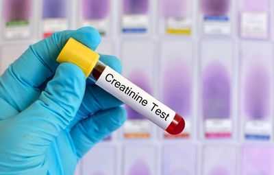 Прохождение тестирования крови на уровень креатинина