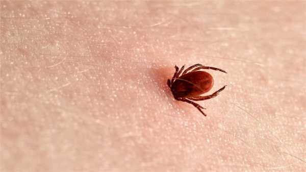 Клещевой энцефалит: симптомы и диагностика