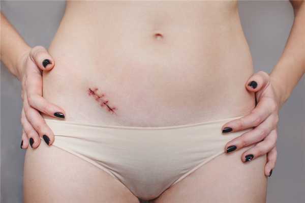 Признаки воспаления и прочих осложнений