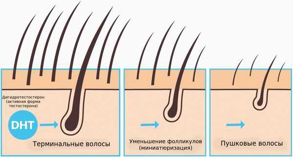 Превращение терминальных фолликулов в веллусоподобные