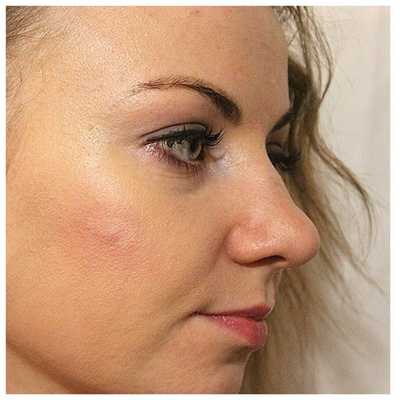 Слишком плотная тоналка