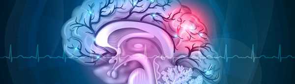 Длительная успешная терапия фокальной эпилепсии (на примере клинического случая)