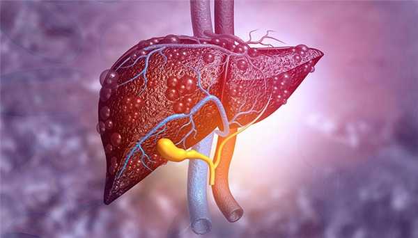 Цирроз печени
