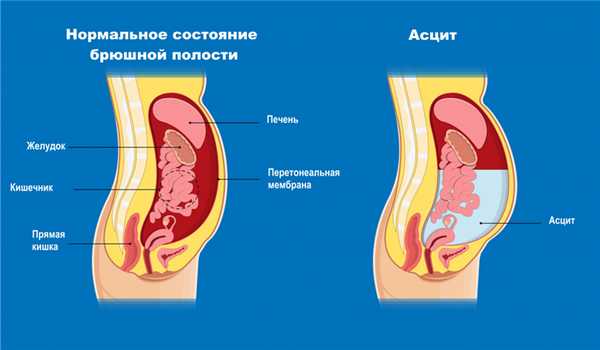 Васильев Роман Владимирович, гастроэнтеролог, гепатолог, врач общей практики - Санкт-Петербург