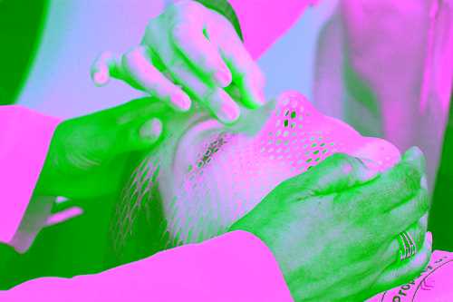 Лучевая терапия при раке мочевого пузыря