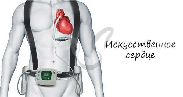 Биоинженерия