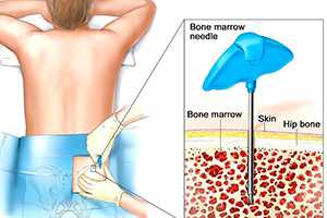 цитогенетические-исследования-пункция-картинка