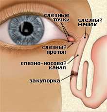 дакриоцистит