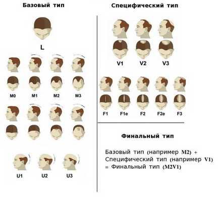 Классификация BASP 