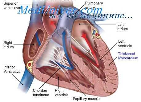 аномалии проводящей системы