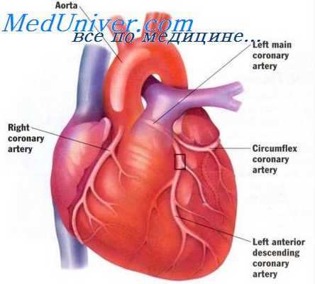 дефект межжелудочковой перегородки