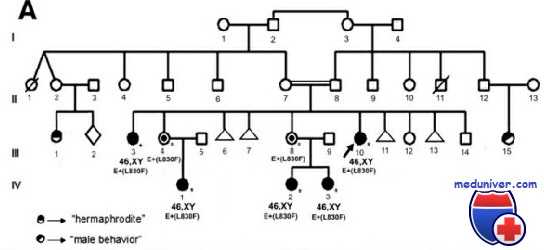 синдром нечувствительности к андрогенам