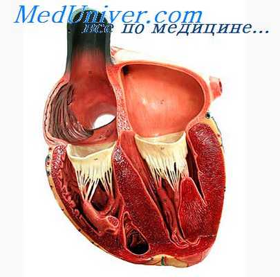 атеросклероз артерий