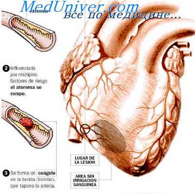 дефицит фолиевой кислоты