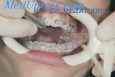 деформации челюсти