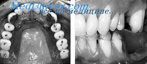 деформации челюсти