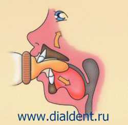 сосание бутылки