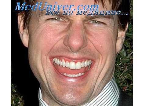 деформаци зубов при рахите