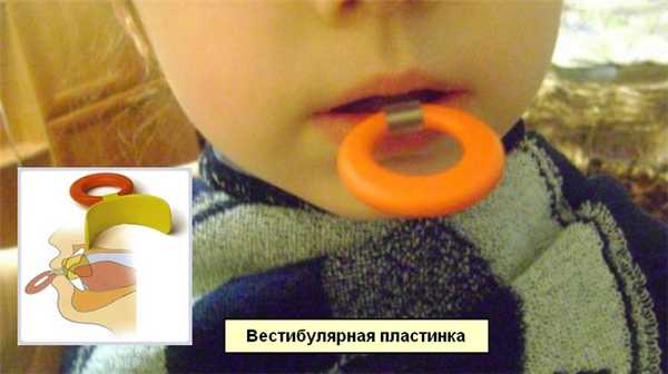 Малыш с вестибулярной пластинкой