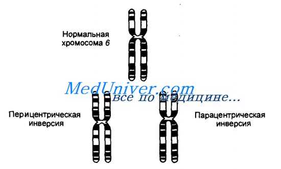 Инсерции. Что такое инсерция? Инверсии. Что такое инверсия?