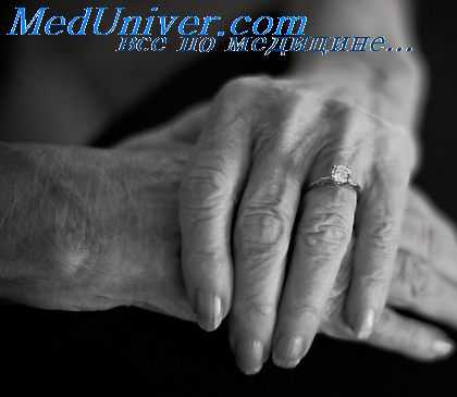 лечение необратимой деменции