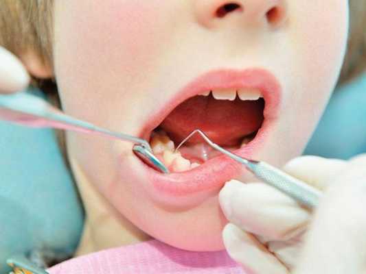 Зондирование