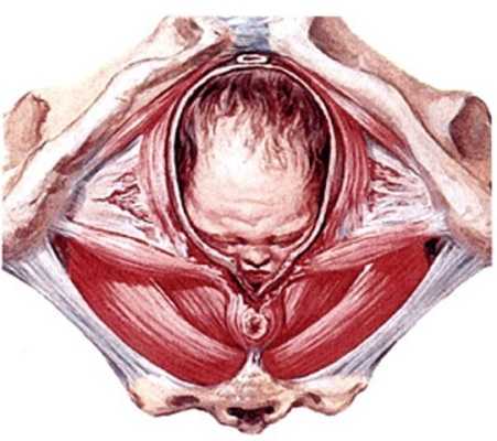 Травма промежности во время родов