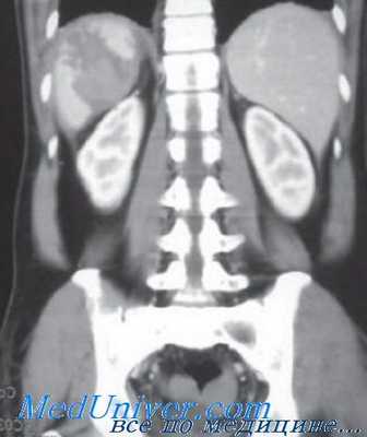 лечение травм живота