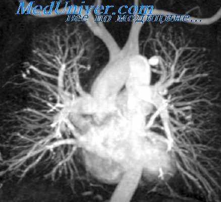 легочная хирургия