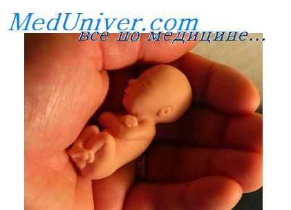 мозаицизм хромосом