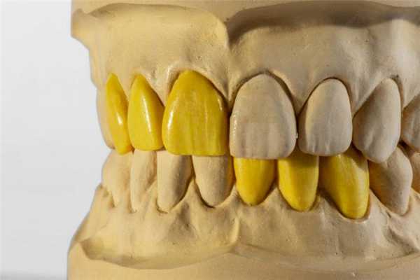 Восковое моделирование зубов