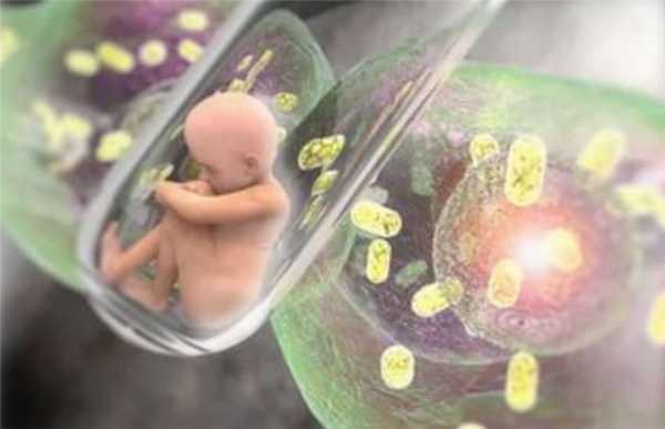 пороки плода