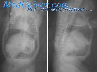 пищеварительный тракт